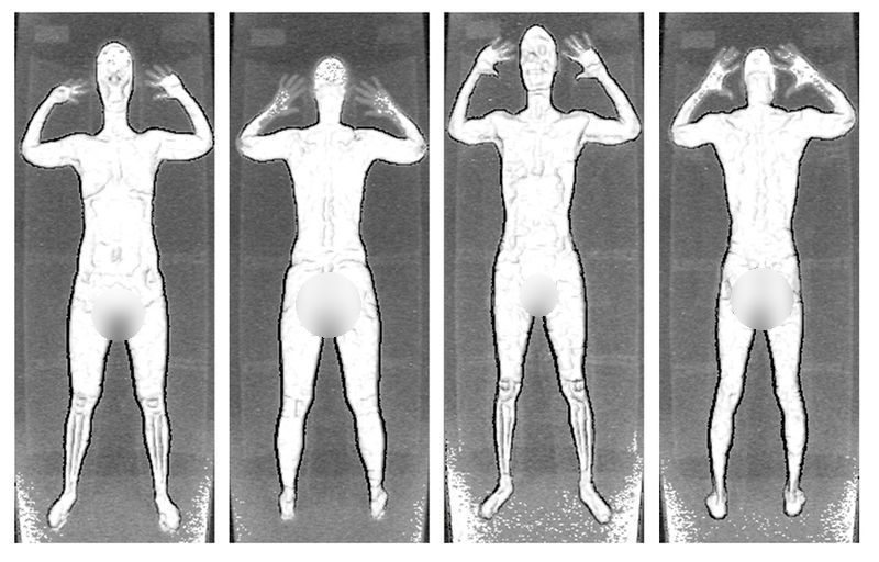Naked scanned full body images