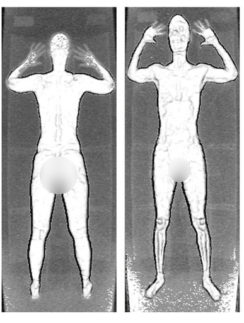 backscatter body images