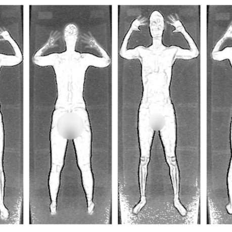 backscatter body images