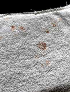 blood stains AC Coslada