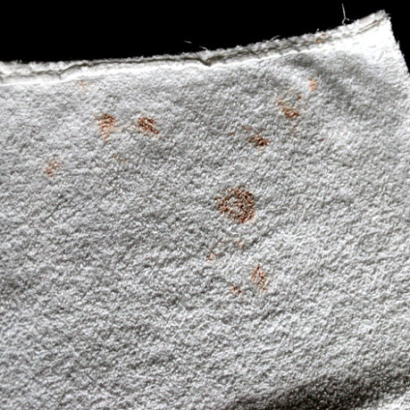 blood stains AC Coslada