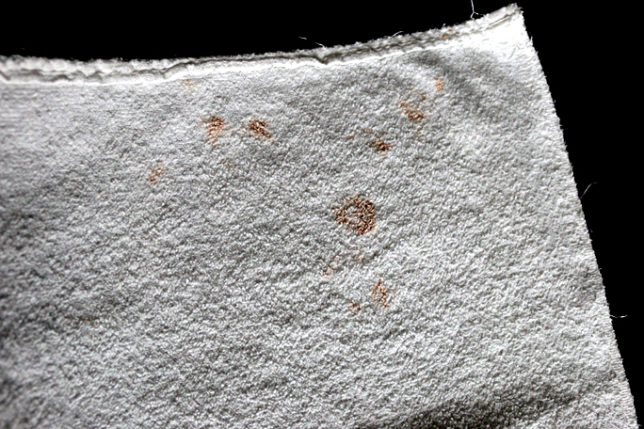 blood stains AC Coslada
