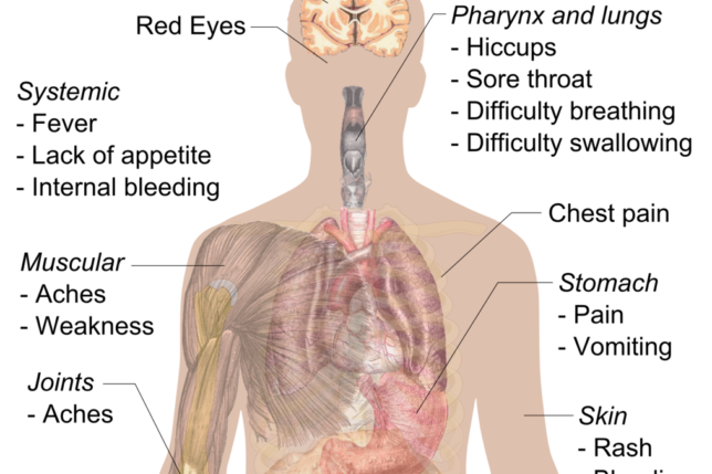 Ebola virus disease epidemic