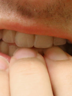 Apprehension trepidation