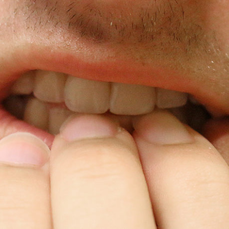 Apprehension trepidation