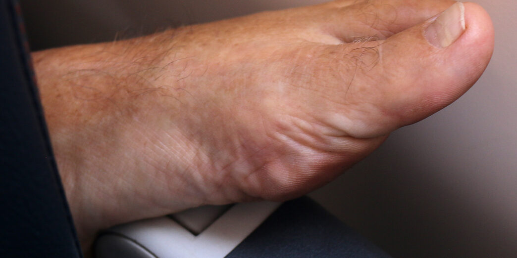 a foot with a toenail