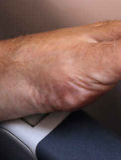 a foot with a toenail