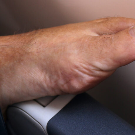 a foot with a toenail